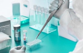 Рекорден брой PCR тестове у нас - 4525