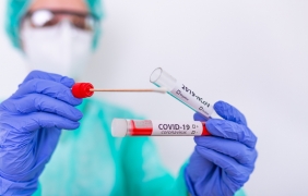 Новите случаи на Covid-19 забавят ръст